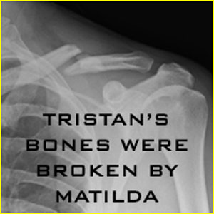 Tristan's Bones Were Broken By Matilda